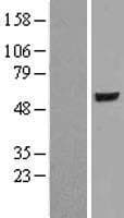 ER81 / ETV1 Protein (Over-Expression Lysate Myc-DDK (Flag))