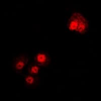 Polyclonal Rabbit anti-Human TUBA4A / TUBA1 Antibody (IF, WB)