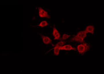 ALDP / ABCD1 Antibody