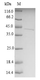Human MTX2 Protein (Recombinant GST, N-terminus)