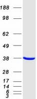 Human ARA9 / AIP Protein (Recombinant Myc-DDK (Flag))