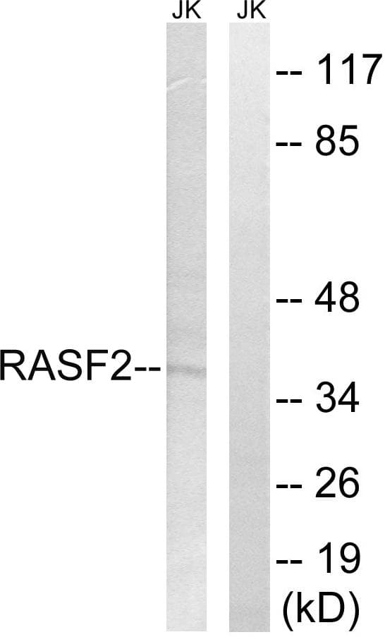 RASSF2 Antibody