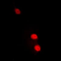 RAP30 / GTF2F2 Antibody