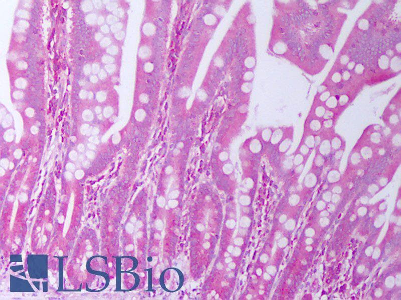 IHC-plus™ TGFA / TGF Alpha Antibody