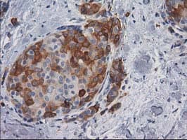 Monoclonal Mouse anti-Human AK5 / Adenylate Kinase 5 Antibody (clone OTI1G3, IHC, WB)