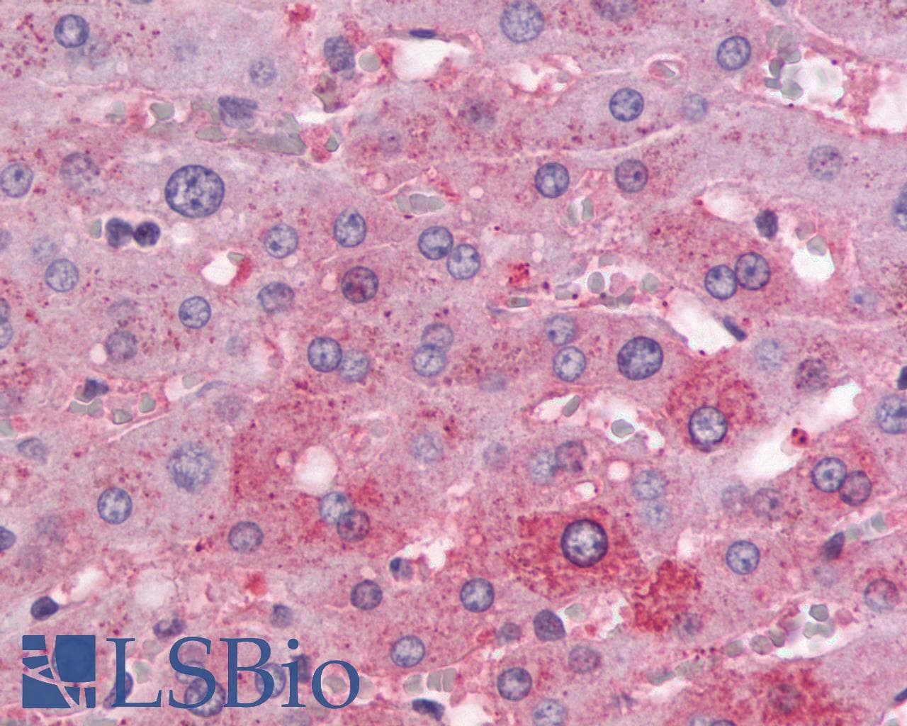 IHC-plus™ PTHR / PTHR1 Antibody (Internal)