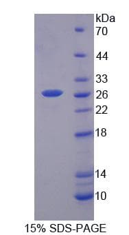 Human BEST2 / Bestrophin-2 Protein (Recombinant His, N-Terminal)