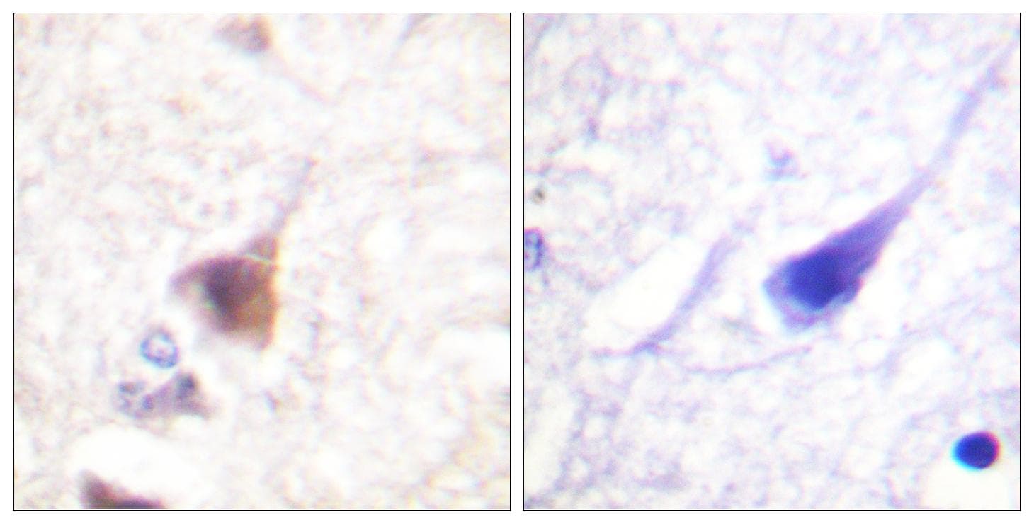 CAMK4 / CaMK IV Antibody (phospho-Thr196/200)