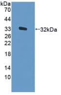 Human EIF2AK2 / PKR Protein (Recombinant His, N-Terminal)