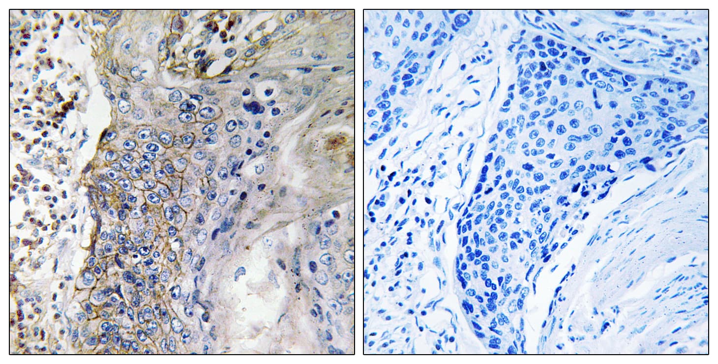 SLC28A2 Antibody (aa371-420)