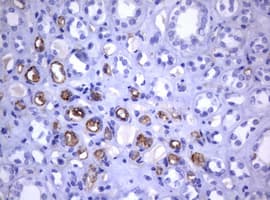 CD30 Antibody (clone OTI18D3)