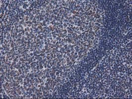 CTDSP1 / SCP1 Antibody (clone OTI1B6)