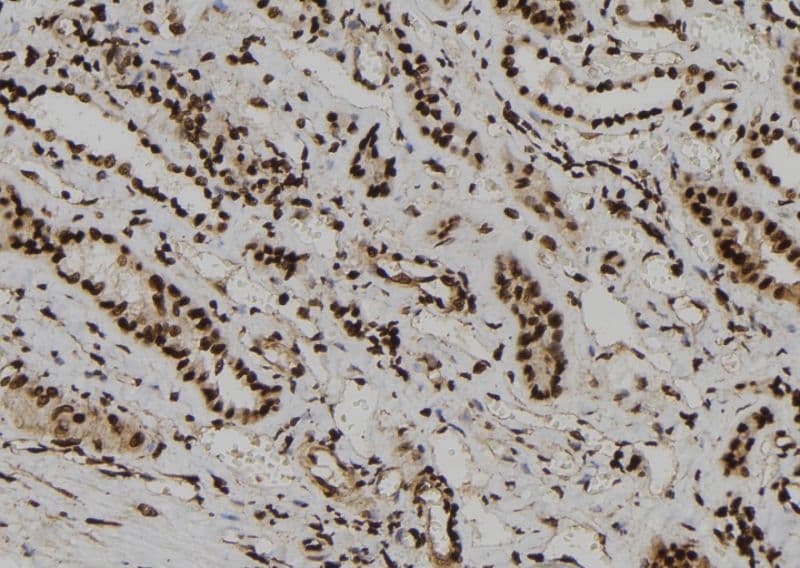 WDR46 Antibody