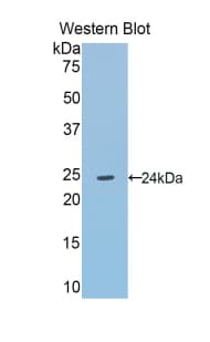 AGT / Angiotensinogen Antibody (aa155-355)