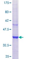 Human AP1M2 Protein (Recombinant GST, N-terminus)
