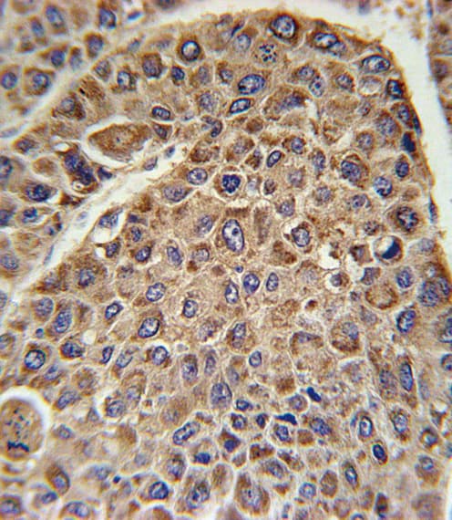 Polyclonal Rabbit anti-Human DLAT / PDC-E2 Antibody (aa579-607, IHC, WB)