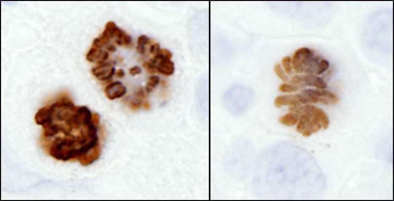 HIST1H3A Antibody (phospho-Ser10)