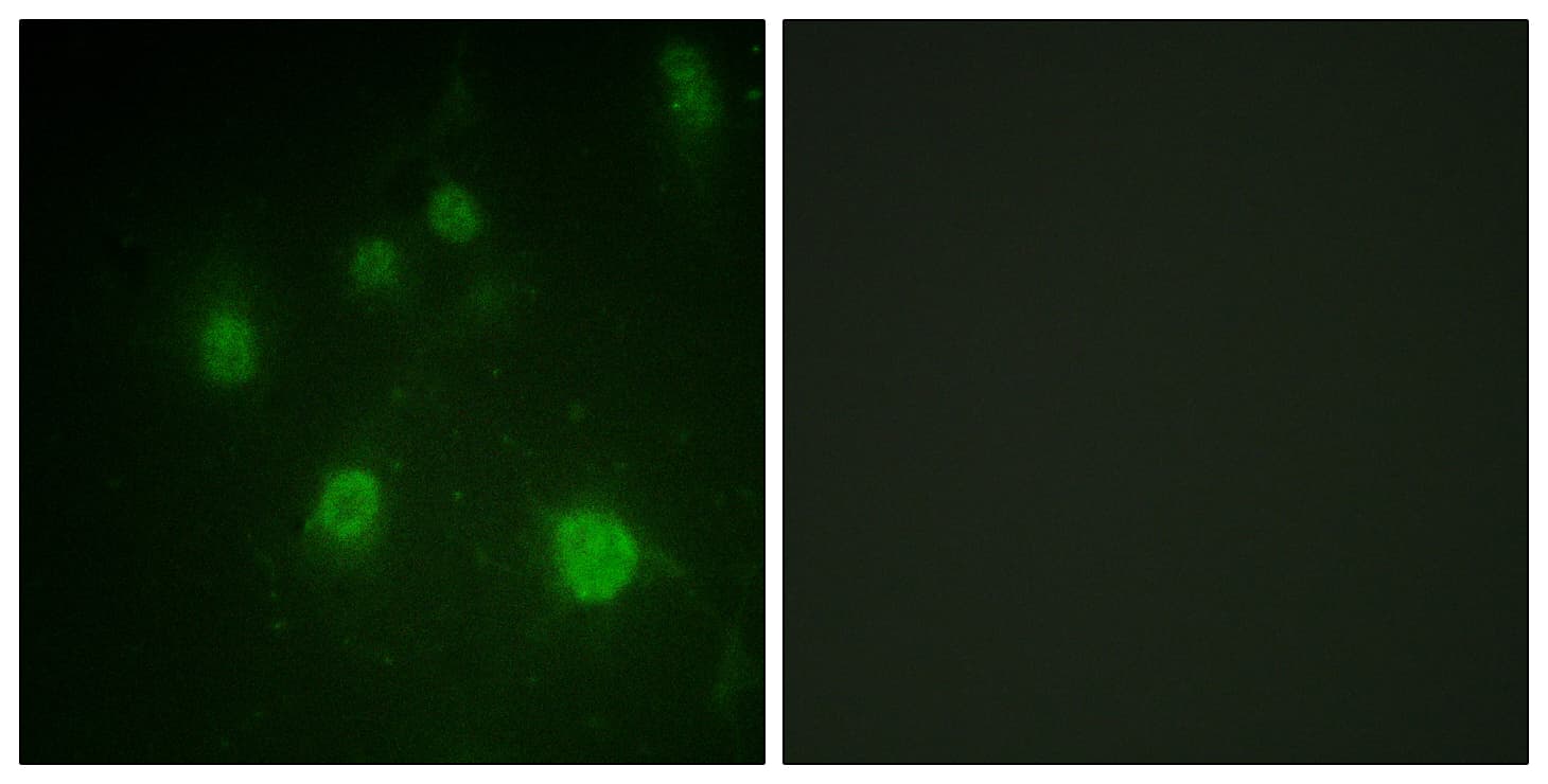 HMGN1 / HMG14 Antibody (phospho-Ser21)