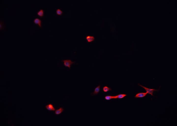 SUMO1 / SMT3 Antibody