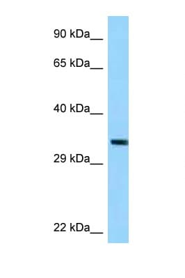 TRUB1 Antibody (C-Terminus)