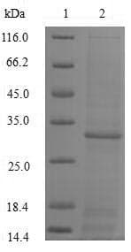 Rat SNCA / Alpha-Synuclein Protein (Recombinant GST, N-terminus)