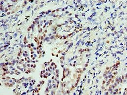 IMPDH2 Antibody (aa215-514)