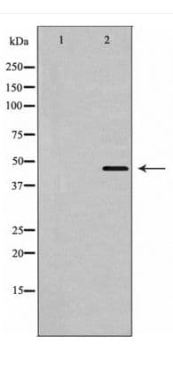 Polyclonal Rabbit anti-Human SLC16A3 Antibody (WB)