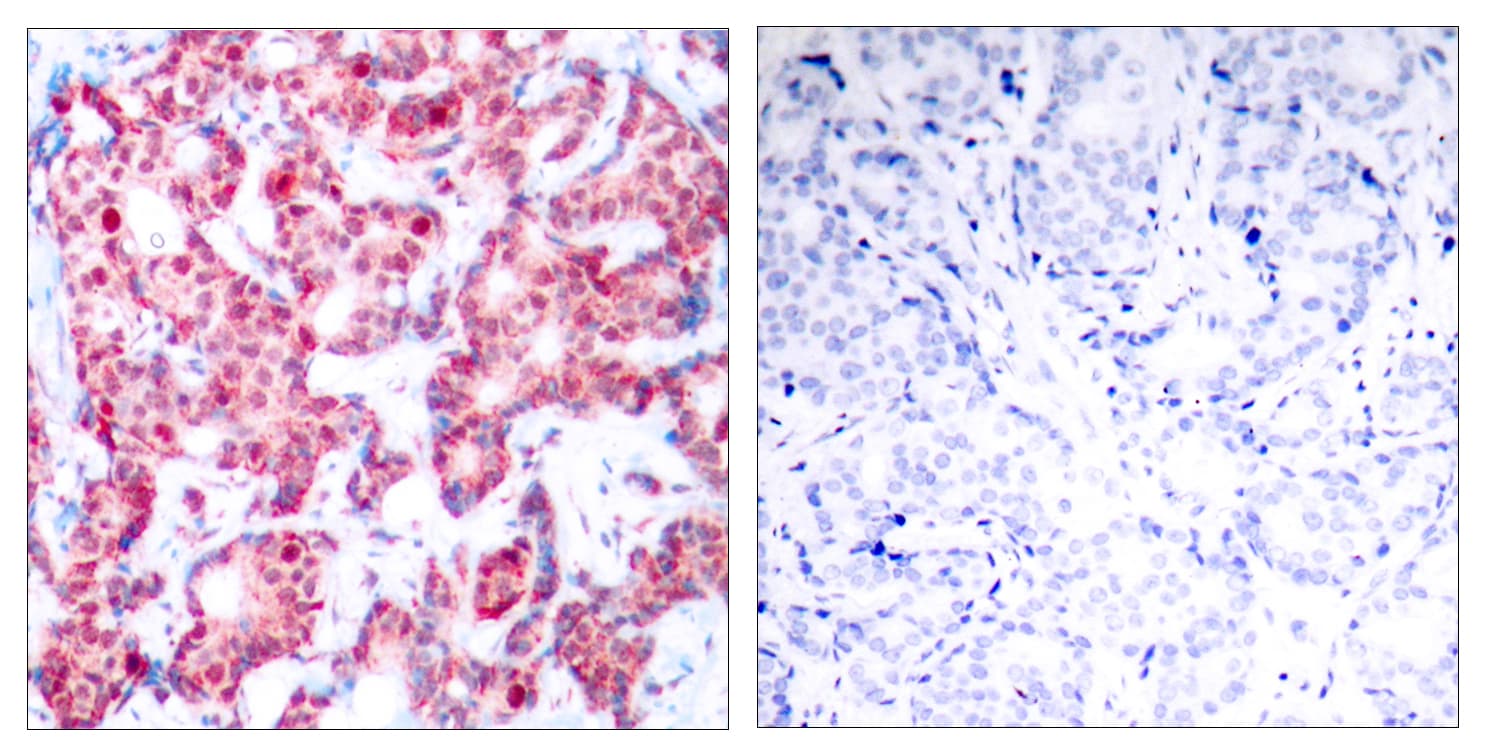 GATA1 Antibody (phospho-Ser142)
