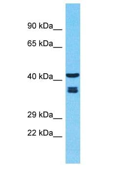OR2B11 Antibody (aa219-268)