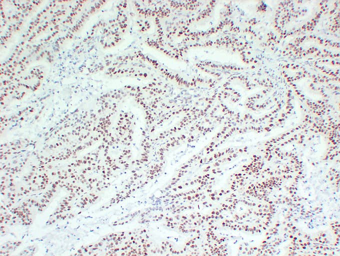 Monoclonal Mouse anti-Human MLH1 Antibody (clone ABT-MLH1, IHC, WB)