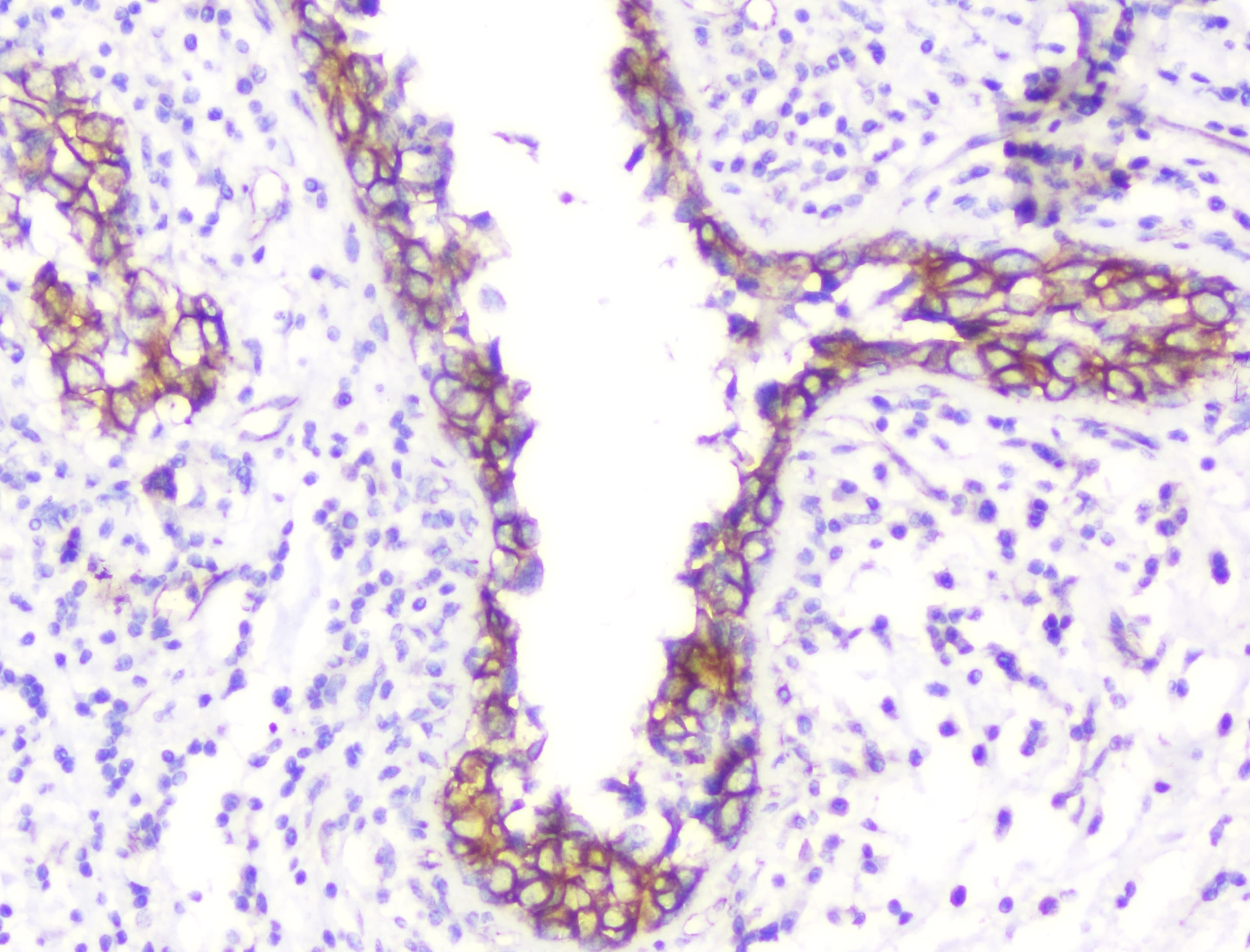 CTNNB1 / Beta Catenin Antibody