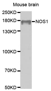 Polyclonal Rabbit anti-Human NOS1 / nNOS Antibody (IHC, WB)