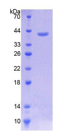 Human MUC3A Protein (Recombinant His-GST)