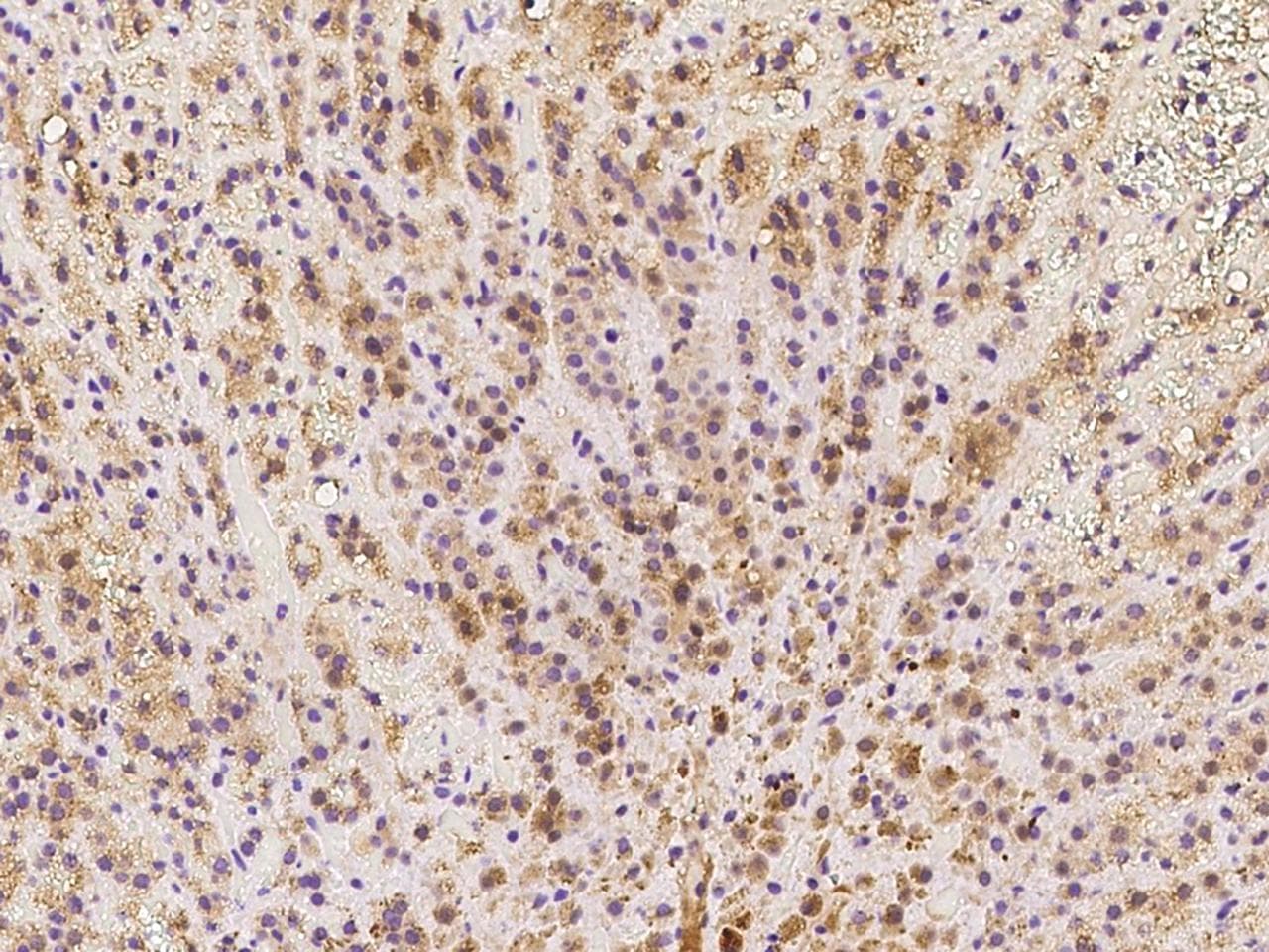 MMP15 Antibody