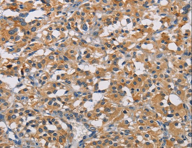Polyclonal Rabbit anti-Human GPM6A / Glycoprotein M6A Antibody (IHC, WB)