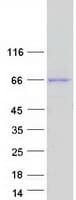 Human IKZF1 / IKAROS Protein (Recombinant Myc-DDK (Flag))