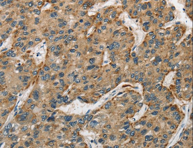 CTSE / Cathepsin E Antibody
