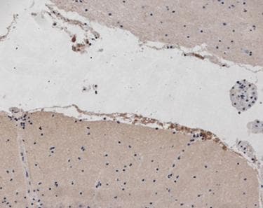 Polyclonal Rabbit anti-Mouse NPY2R Antibody (IHC, WB)