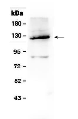 Polyclonal Rabbit anti-Human VCL / Vinculin Antibody (WB)