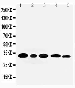 Polyclonal Rabbit anti-Human AQP3 / Aquaporin 3 Antibody (aa278-292, IHC, WB)