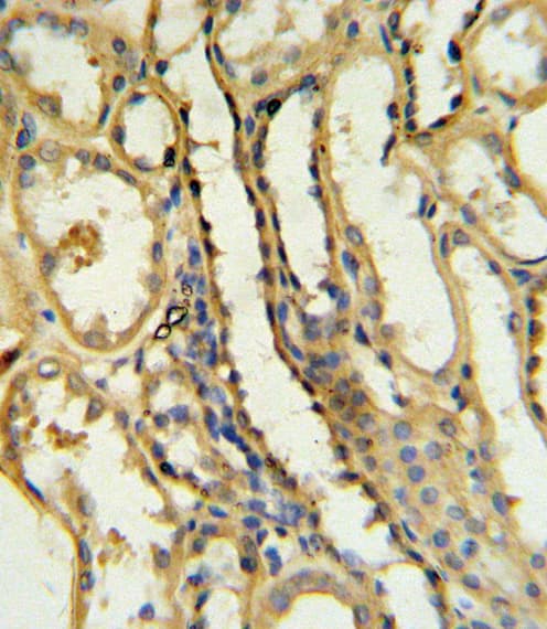 Polyclonal Rabbit anti-Human CD40L Antibody (aa33-62, IHC, IF, WB)