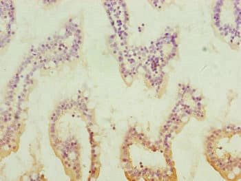 QRSL1 / GatA Antibody