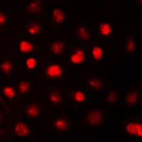 RB1 / Retinoblastoma / RB Antibody (C-Terminus)