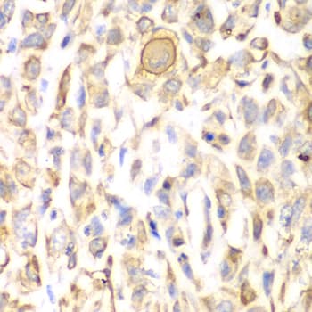 Polyclonal Rabbit anti-Human CD151 Antibody (IHC, WB)