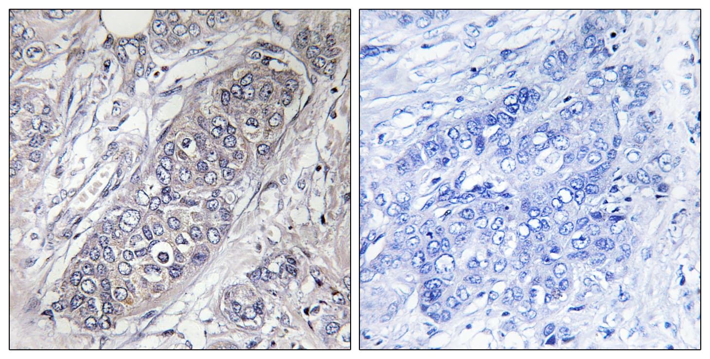 EIF4EBP1 / 4EBP1 Antibody (aa13-62)