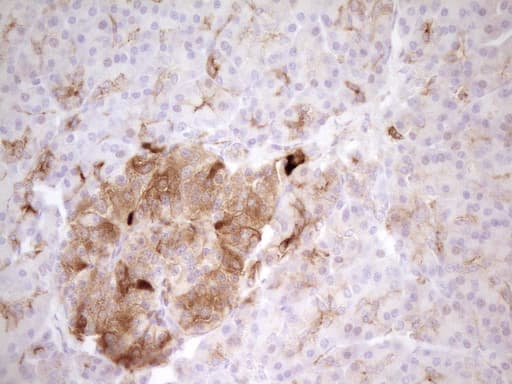 PROCR / EPCR Antibody (aa1-210, clone UMAB200)
