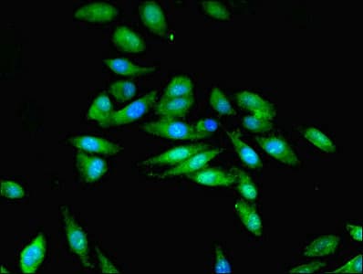 STK33 Antibody