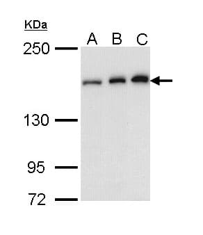 Rho Kinase / ROCK1 Antibody (aa107-371)
