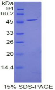 Human EREG / Epiregulin Protein (Recombinant His-GST)