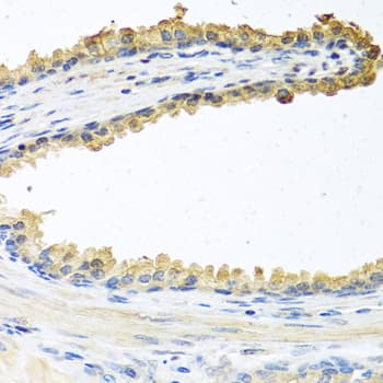 Cochlin / COCH Antibody